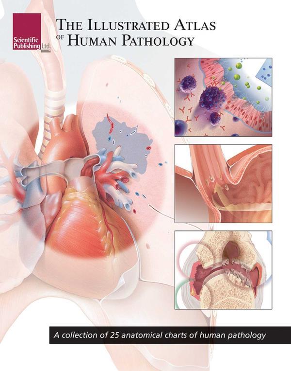 The Illustrated Atlas of Human Pathology (Atlas Series)