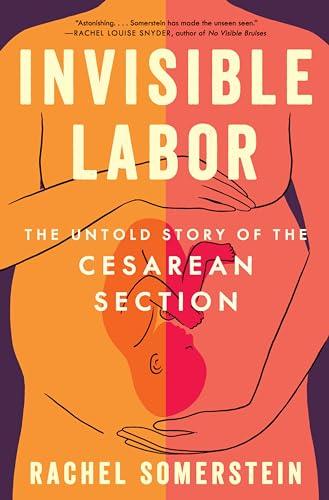 Invisible Labor: The Untold Story of the Cesarean Section